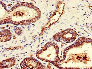 Polyclonal Rabbit anti-Human GAREM / FAM59A Antibody