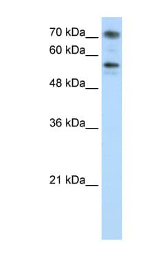 Polyclonal Rabbit anti-Human BRD7 Antibody (C-Terminus, IHC, WB)