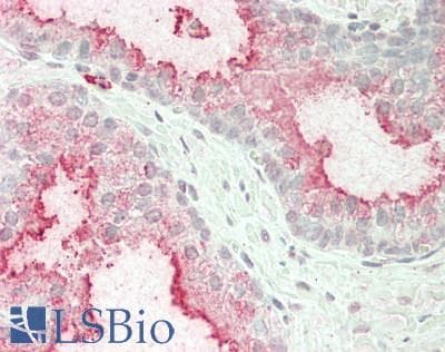 IHC-plus™ HSPA13 Antibody (clone 1H8)