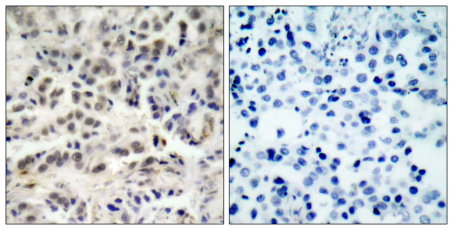 CDKN1B / p27 Kip1 Antibody (aa1-50)