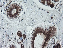 Monoclonal Mouse anti-Human TRIM44 Antibody (clone OTI1E10, IHC, IF, WB)