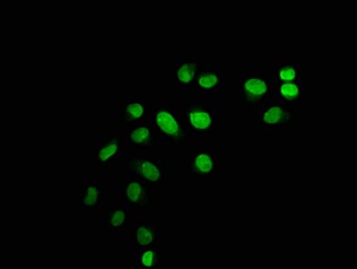Polyclonal Rabbit anti-Human HIST1H1C Antibody (WB)