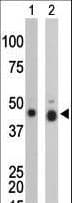 Polyclonal Rabbit anti-Human CKB / Creatine Kinase BB Antibody (aa1-30, WB)