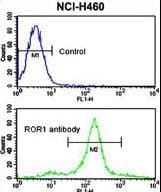 Polyclonal Rabbit anti-Human ROR1 Antibody (IHC, WB)