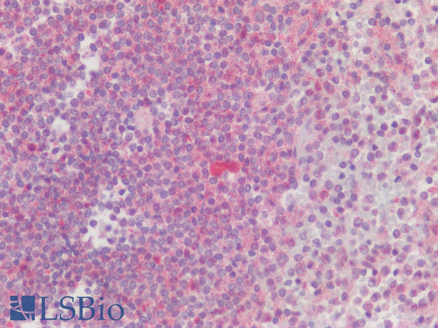 IHC-plus™ Polyclonal Rabbit anti-Human DKK1 Antibody (Internal Region, IHC, WB)
