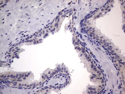 PRX-1 / PRRX1 Antibody (clone OTI1E10)