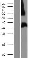 SLIM / FHL1 Protein (Over-Expression Lysate Myc-DDK (Flag))