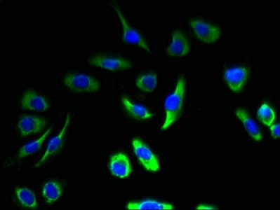 IHC-plus™ CALM1 / Calmodulin Antibody