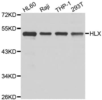 Polyclonal Rabbit anti-Human HLX1 / HLX Antibody (IHC, IF, WB)