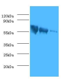 Rabies Virus gG Antibody (aa20-459)