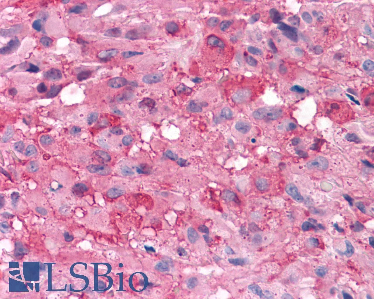 PathPlus™ Polyclonal Rabbit anti-Human GRM7 / MGLUR7 Antibody (N-Terminus, IHC, WB)