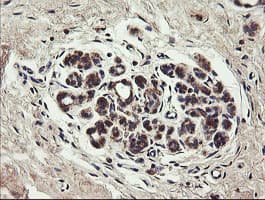 UBE2J1 Antibody (clone OTI3D1)