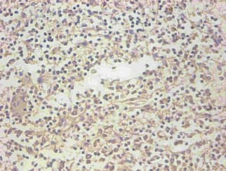 IHC-plus™ LCN2 / Lipocalin 2 / NGAL Antibody