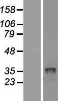 CRHBP Protein (Over-Expression Lysate Myc-DDK (Flag))