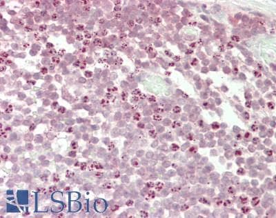 IHC-plus™ METTL3 Antibody (aa1-50)