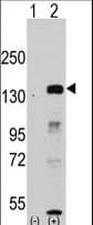 JHDM1A / KDM2A Antibody (aa500-527)