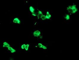 IHC-plus™ MAC-2-BP / LGALS3BP Antibody (clone 1C2)