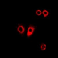 PDI / P4HB Antibody