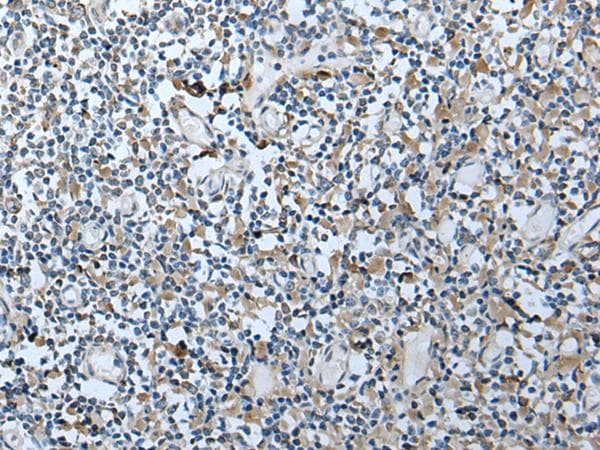 VDAC1 / PORIN Antibody
