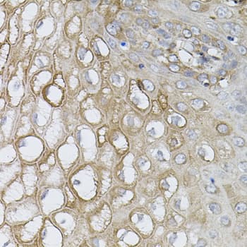 UBE2A Antibody