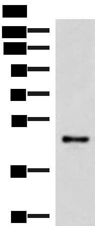 IRX2 Antibody