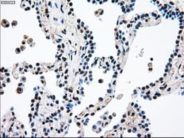 MAP2K4 / MKK4 Antibody (clone OTI1D6)