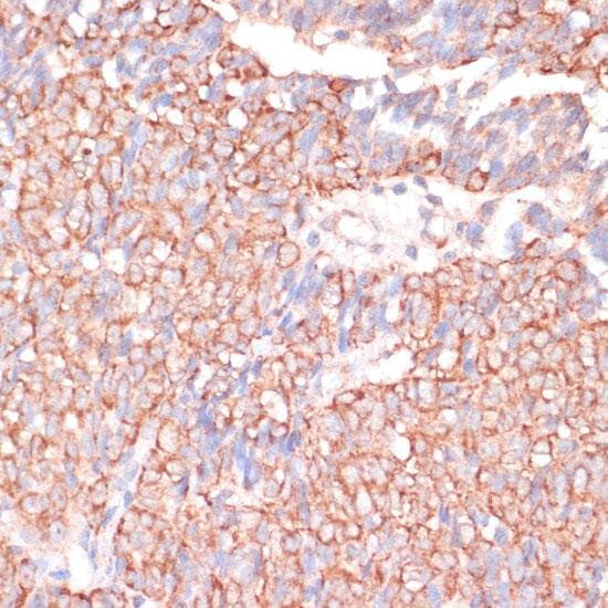 Polyclonal Rabbit anti-Human ACAT2 Antibody (IHC, IF)