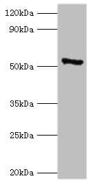 Polyclonal Rabbit anti-Human CAMK4 / CaMK IV Antibody (aa304-473, WB)