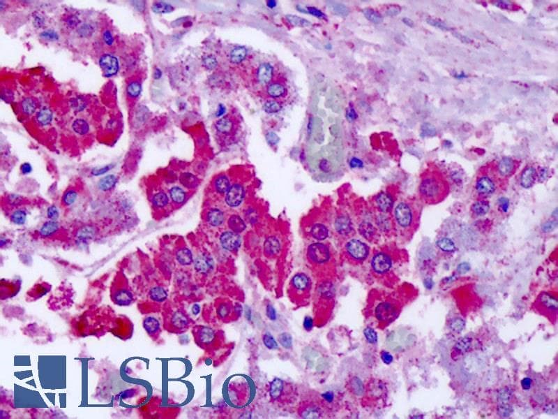 IHC-plus™ GRM7 / MGLUR7 Antibody (N-Terminus)