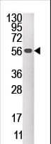 DUSP4 / MKP2 Antibody (aa331-361)