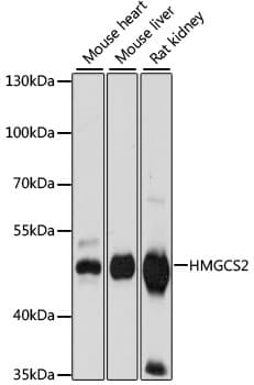 HMGCS2 / HMG-CoA Synthase 2 Antibody
