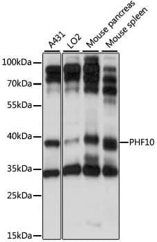 Polyclonal Rabbit anti-Human PHF10 Antibody (WB)