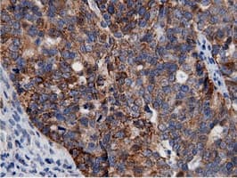 AK5 / Adenylate Kinase 5 Antibody (clone OTI2F9)
