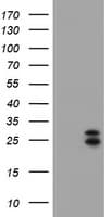CMPK / CMPK1 Antibody (clone OTI1H3)