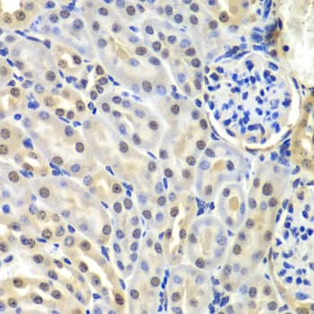 Polyclonal Rabbit anti-Human SNRPD2 Antibody (IHC, IF, WB)