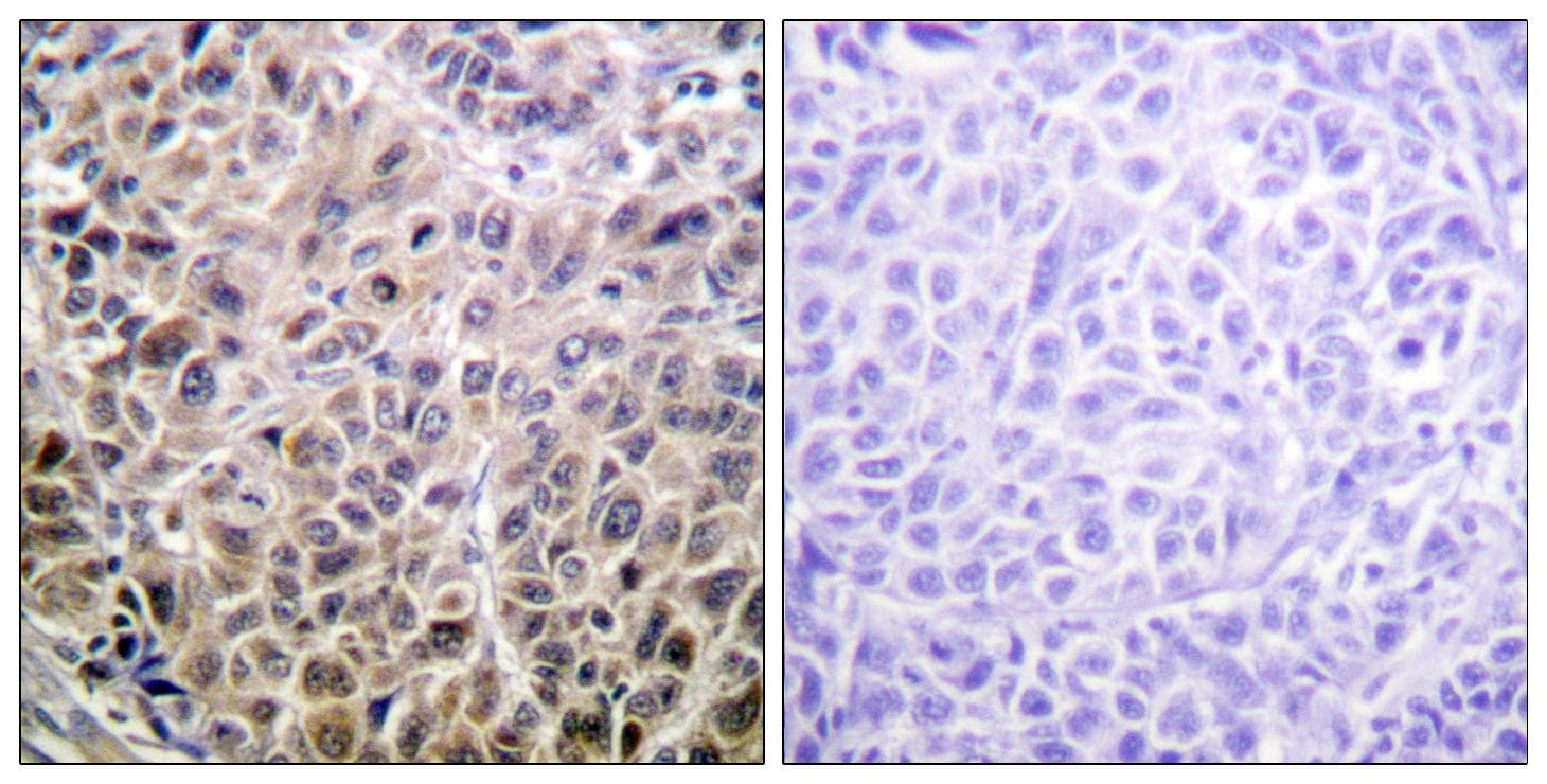 Polyclonal Rabbit anti-Human DAPK1 / DAP Kinase Antibody (Ab-308, IHC, IF)