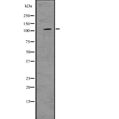 PRKD2 / PKD2 Antibody
