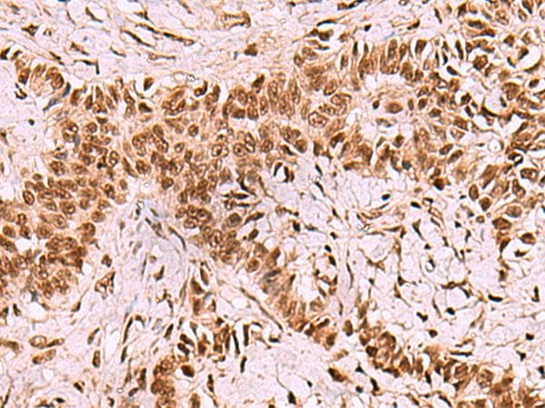 Polyclonal Rabbit anti-Human LDB1 / CLIM2 Antibody (IHC, WB)