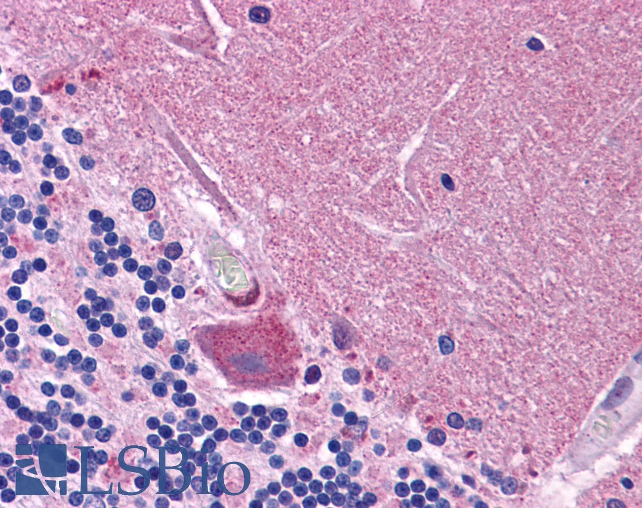 IHC-plus™ Polyclonal Rabbit anti-Human SYNGR1 / Synaptogyrin 1 Antibody (IHC, IF, WB)