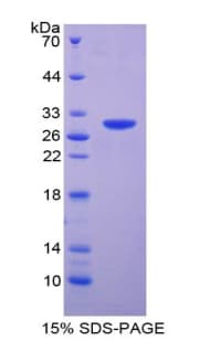 Mouse MOK / RAGE Protein (Recombinant His-T7)
