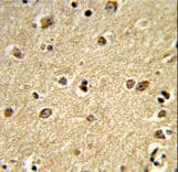 Polyclonal Rabbit anti-Human PLCB2 Antibody (aa174-202, IHC, WB)