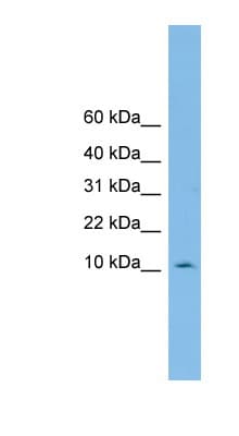 PHF5A / INI Antibody (C-Terminus)