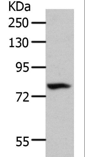 Polyclonal Rabbit anti-Human MME / CD10 Antibody (IHC, WB)