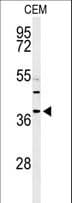 RNASEH2B Antibody (aa130-157)
