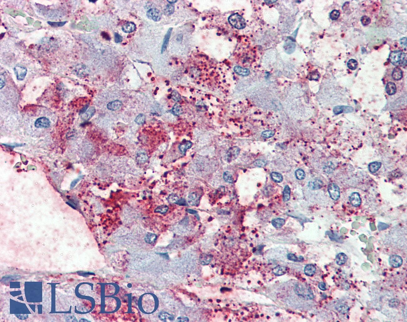 IHC-plus™ THEM6 / C8orf55 Antibody (Internal)