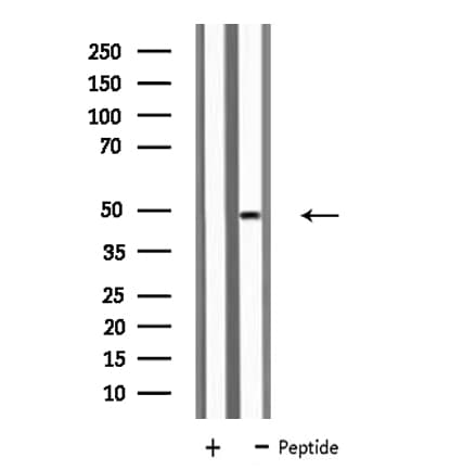 KCNN4 / KCa3.1 Antibody