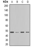 Polyclonal Rabbit anti-Human FDFT1 / Squalene Synthase Antibody (IF, WB)