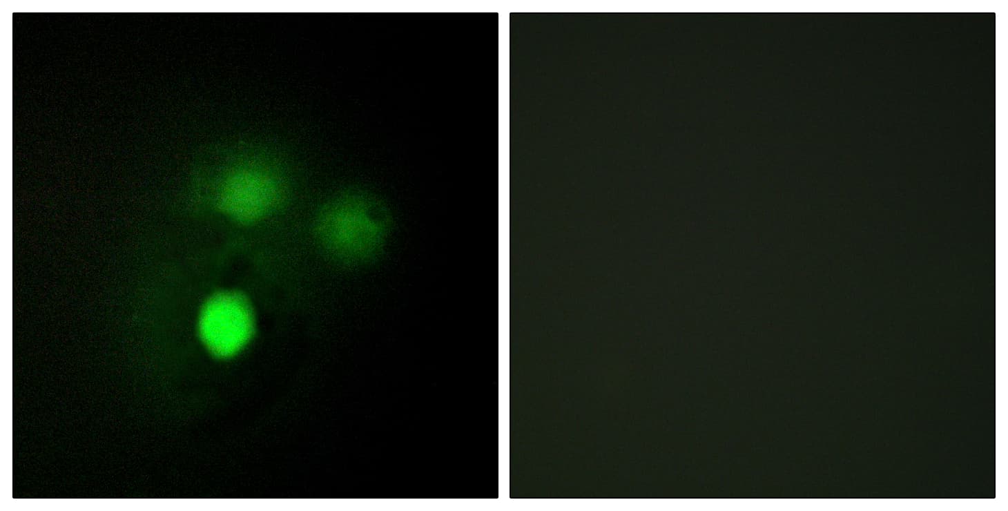 IHC-plus™ HEC1 / NDC80 Antibody (aa351-400)