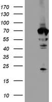 NMT2 Antibody (clone OTI1G3)