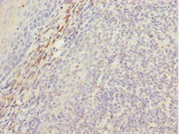 MEOX1 Antibody